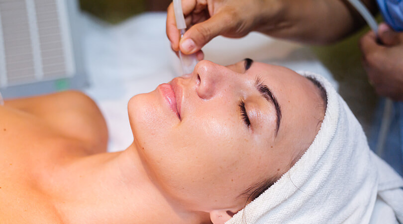 2-Pass Microneedling Calgary