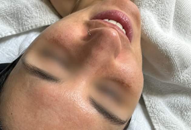 Before treatment comparison