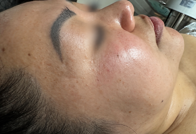 Before treatment comparison