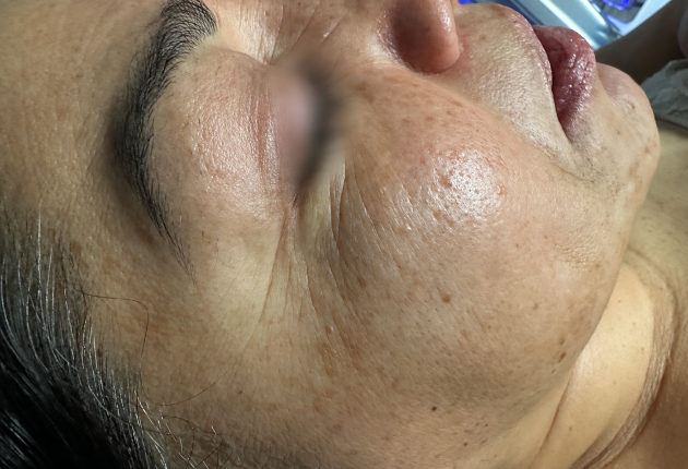 Before treatment comparison