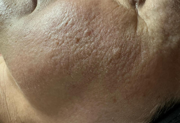 Before treatment comparison