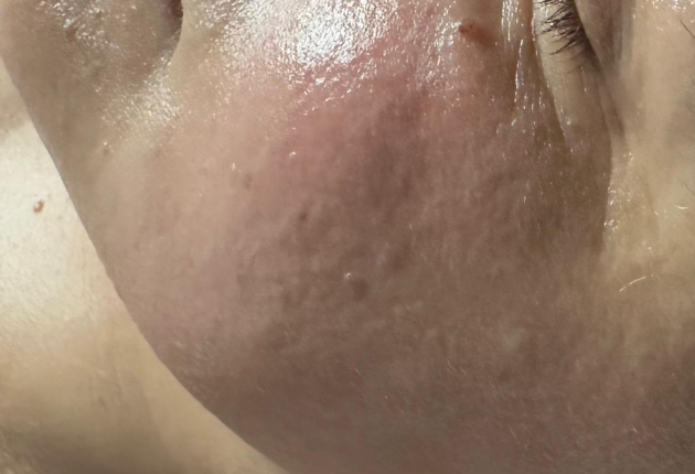 After treatment comparison