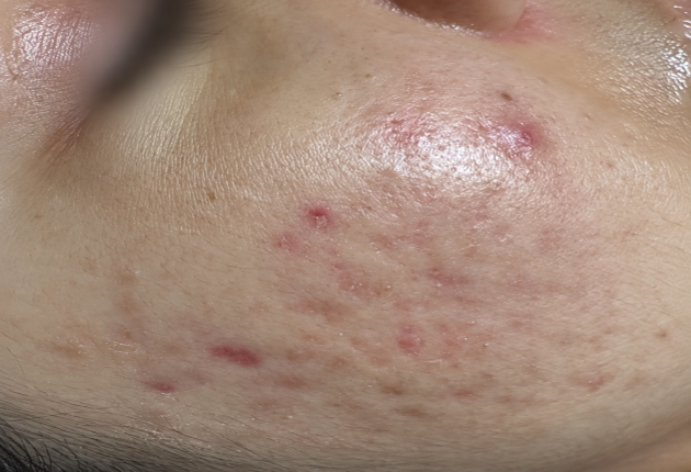 Before treatment comparison