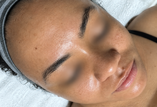 After treatment comparison