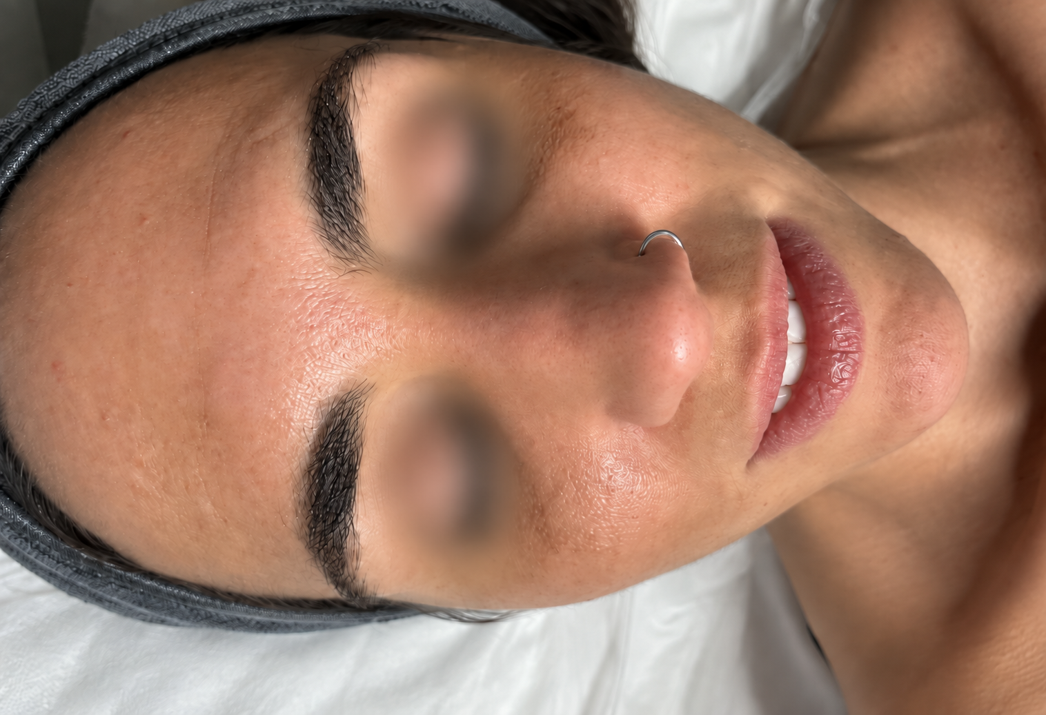 Advanced skin treatment before comparison