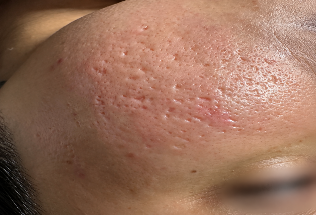After treatment comparison