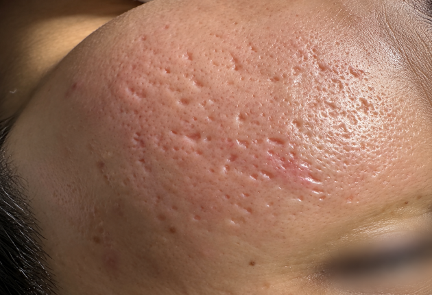 Before treatment comparison
